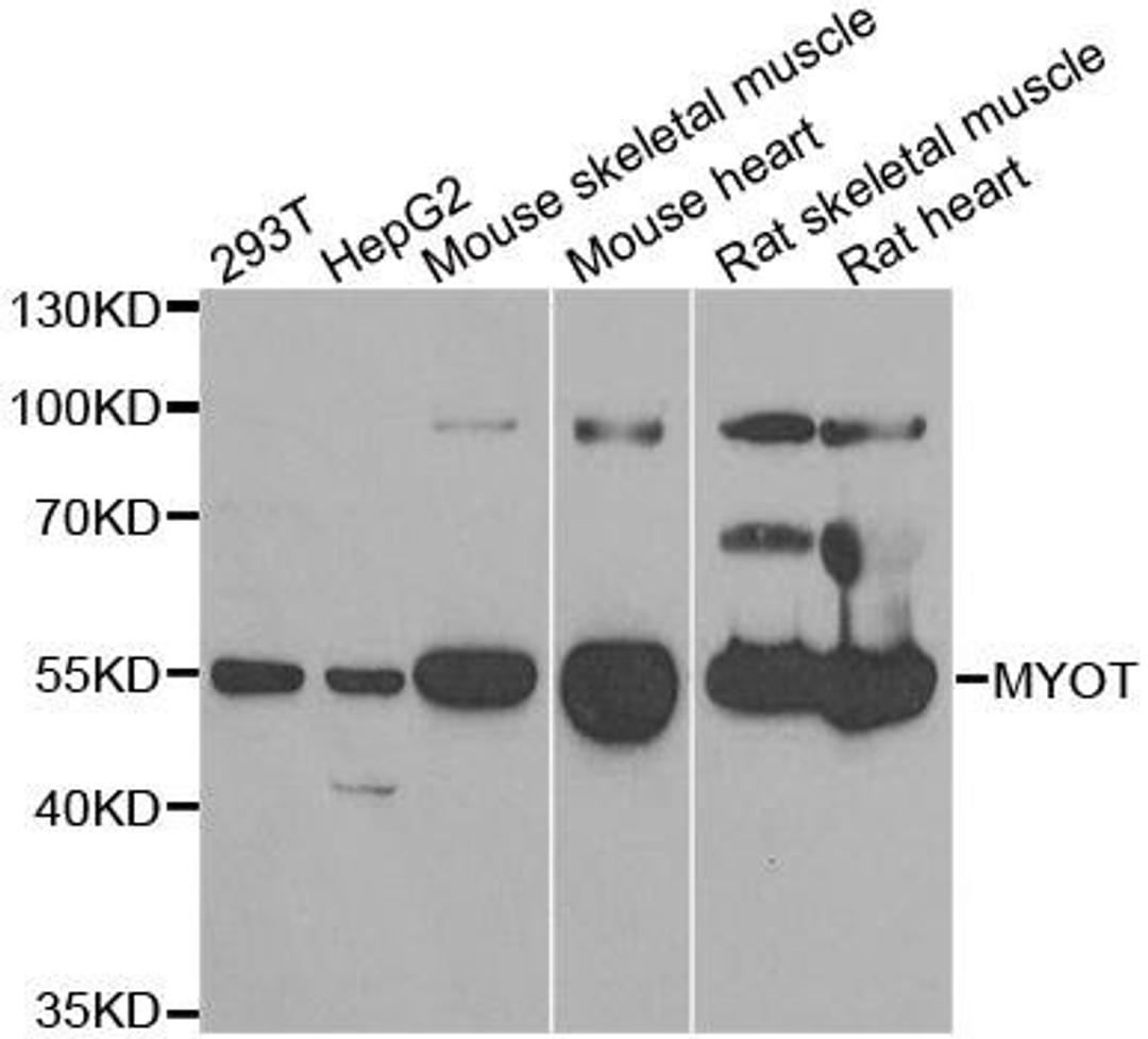 Western blot analysis of extracts of various cell lines using MYOT antibody