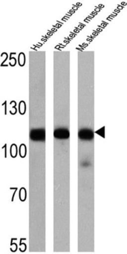 Western Blot: SERCA1 ATPase Antibody (IIH11) [NB120-2818] - Analysis of 25 ug of human skeletal muscle (lane 1), rat skeletal muscle (lane 2) and mouse skeletal muscle (lane 3) onto an SDS polyacrylamide gel.