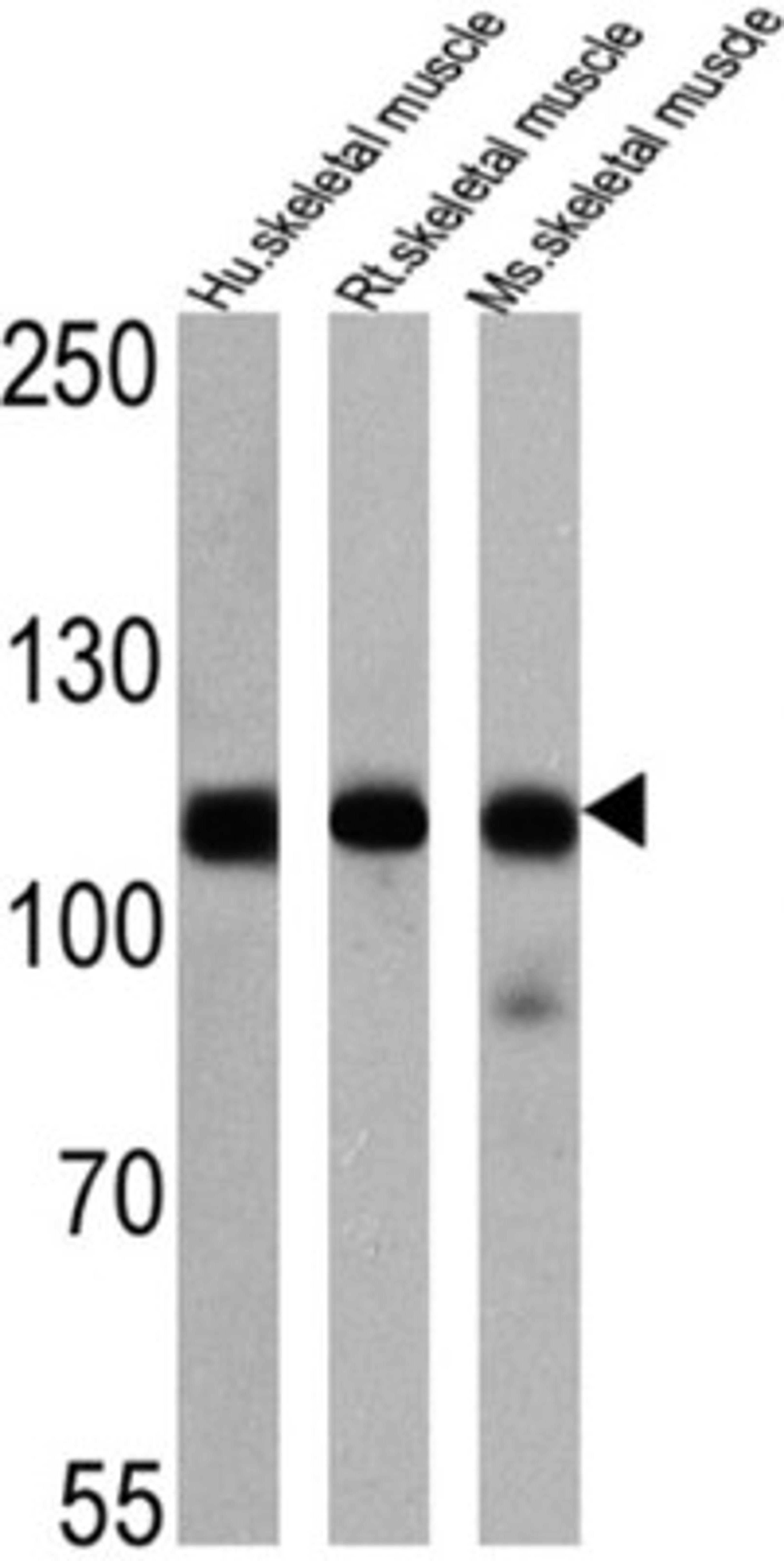 Western Blot: SERCA1 ATPase Antibody (IIH11) [NB120-2818] - Analysis of 25 ug of human skeletal muscle (lane 1), rat skeletal muscle (lane 2) and mouse skeletal muscle (lane 3) onto an SDS polyacrylamide gel.