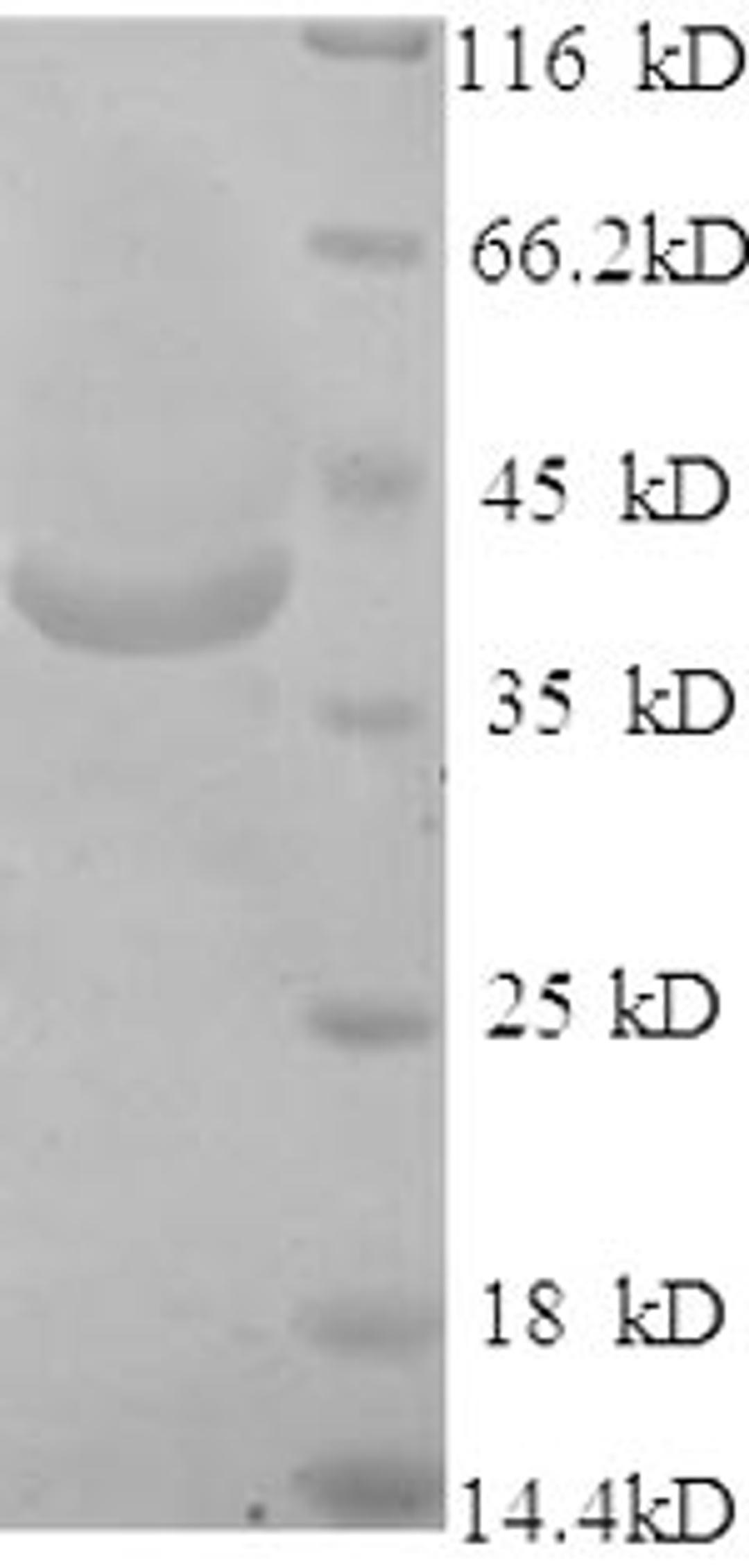 (Tris-Glycine gel) Discontinuous SDS-PAGE (reduced) with 5% enrichment gel and 15% separation gel.