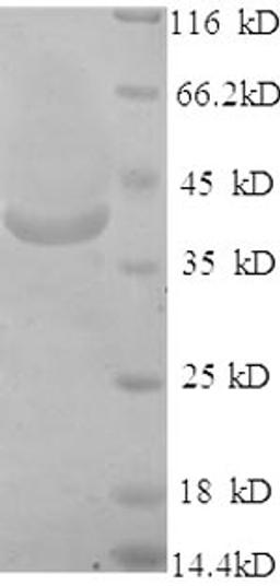 (Tris-Glycine gel) Discontinuous SDS-PAGE (reduced) with 5% enrichment gel and 15% separation gel.