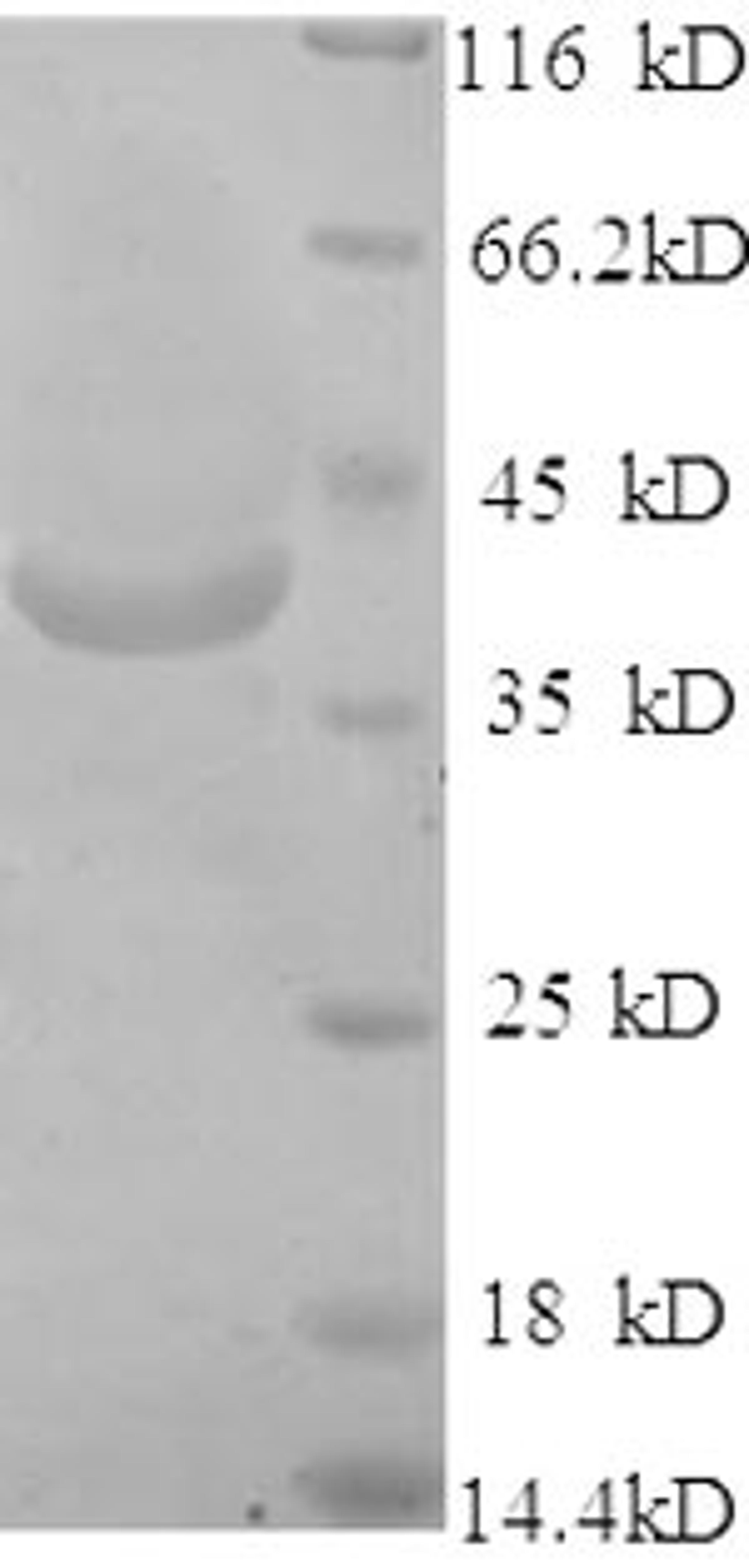 (Tris-Glycine gel) Discontinuous SDS-PAGE (reduced) with 5% enrichment gel and 15% separation gel.