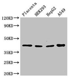 Western Blot. Positive WB detected in: Human placenta tissue, HEK293 whole cell lysate, HepG2 whole cell lysate, A549 whole cell lysate. All lanes: HSD3B1 antibody at 3µg/ml. Secondary. Goat polyclonal to rabbit IgG at 1/50000 dilution. Predicted band size: 43 kDa. Observed band size: 43 kDa