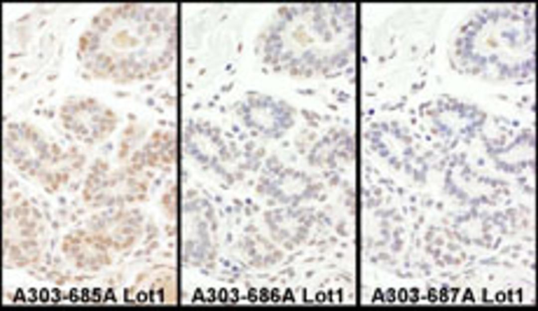 Detection of human TAF5 by immunohistochemistry.