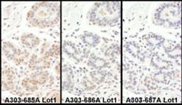 Detection of human TAF5 by immunohistochemistry.