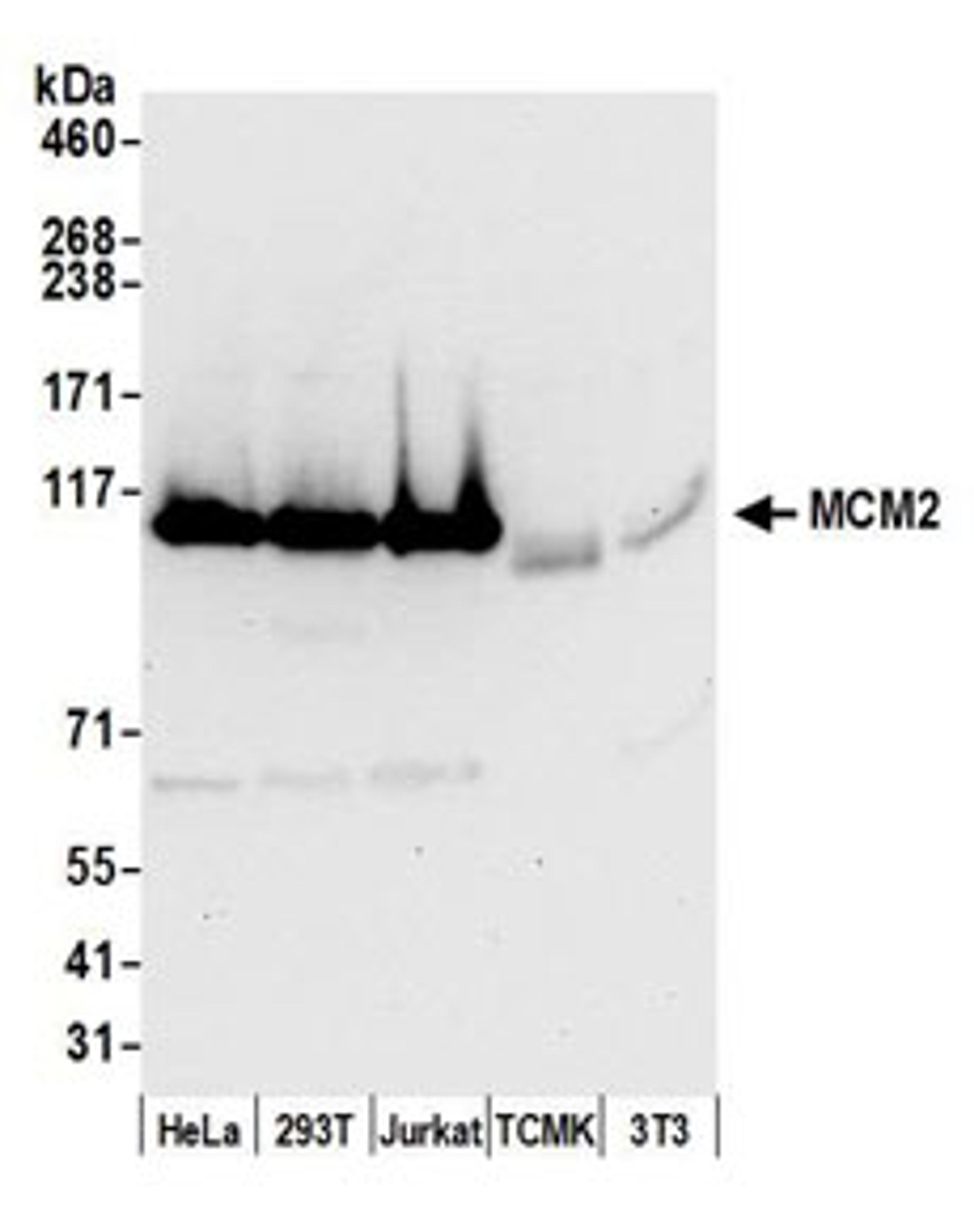 Detection of human and mouse MCM2 by western blot.