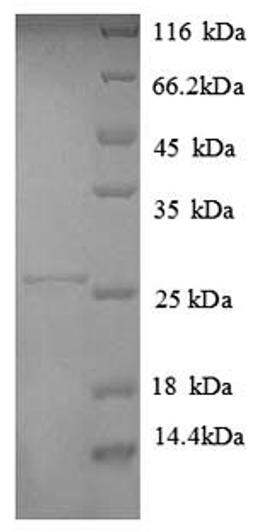 (Tris-Glycine gel) Discontinuous SDS-PAGE (reduced) with 5% enrichment gel and 15% separation gel.