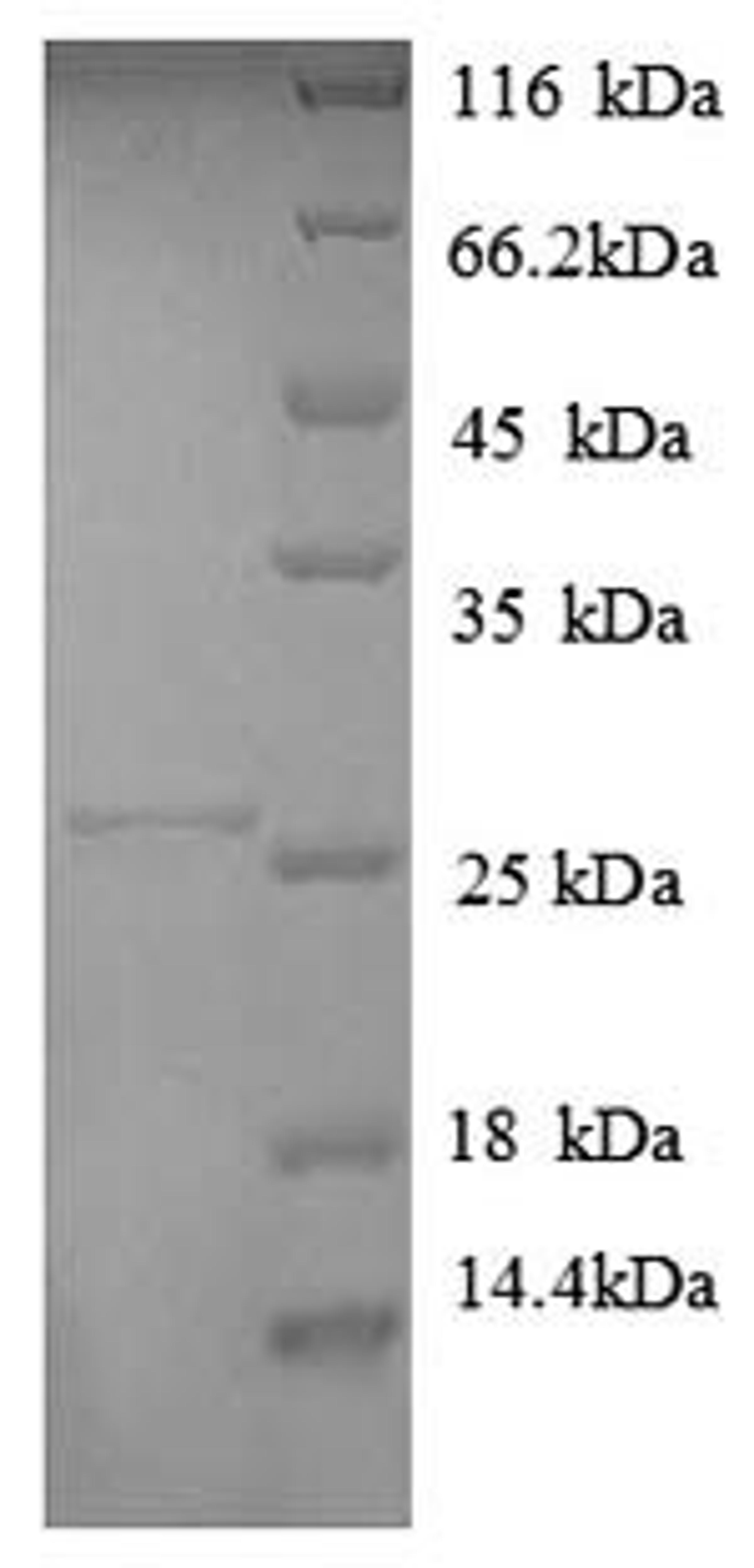 (Tris-Glycine gel) Discontinuous SDS-PAGE (reduced) with 5% enrichment gel and 15% separation gel.