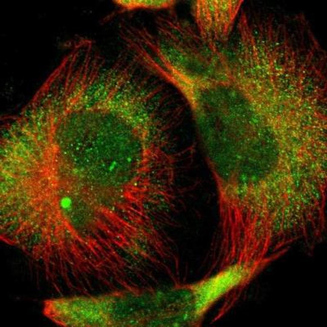 Immunocytochemistry: AMPK beta 1 Antibody [NBP1-87487] - Immunofluorescence:  [NBP1-87487] - Staining of human cell line U-251 MG shows positivity in nucleus but not nucleoli & cytoplasm.