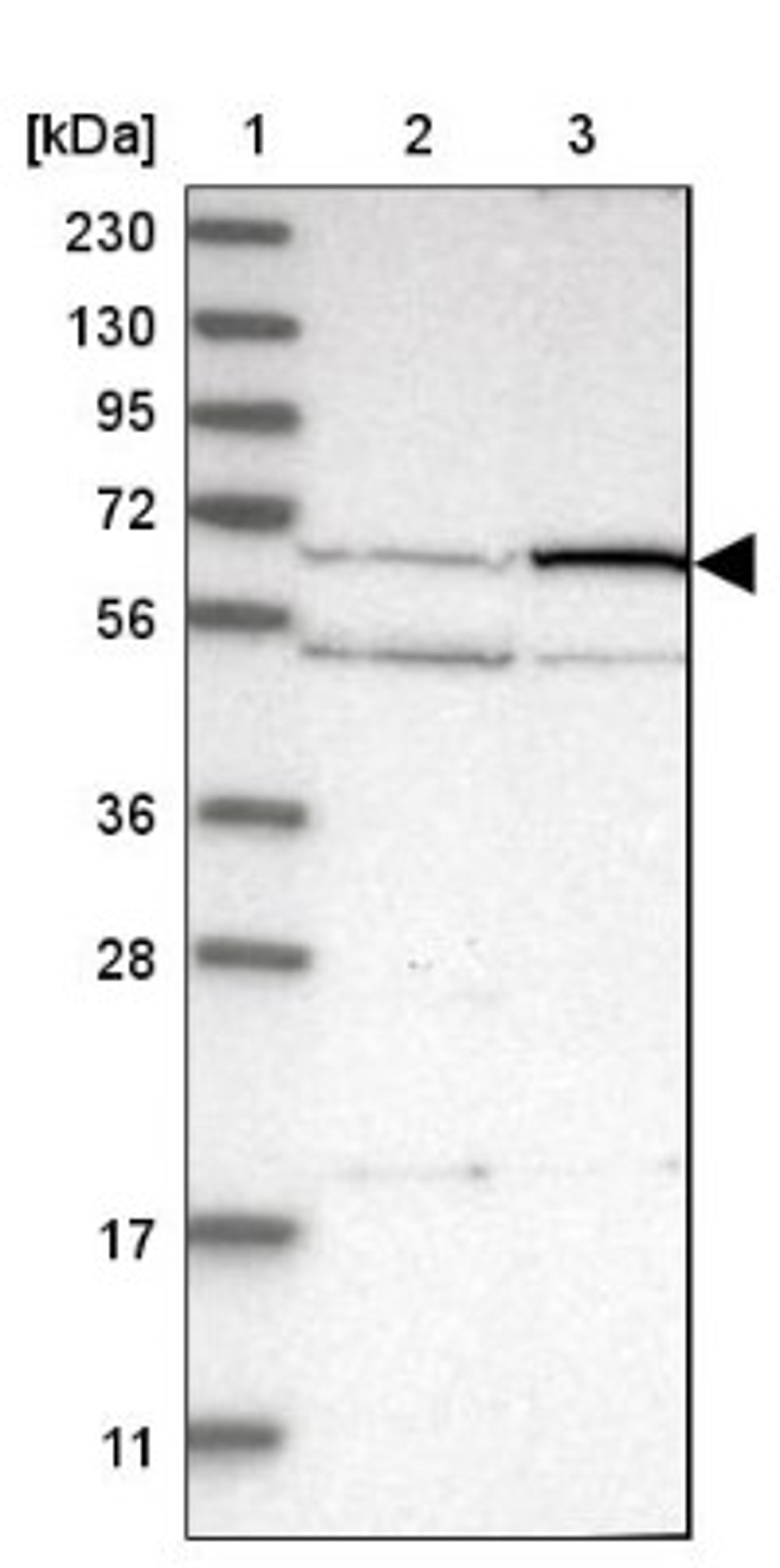 Western Blot: Protein S Antibody [NBP1-87217] - Lane 1: Marker [kDa] 230, 130, 95, 72, 56, 36, 28, 17, 11<br/>Lane 2: Human cell line RT-4<br/>Lane 3: Human cell line U-251MG sp