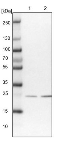 Western Blot: SSSCA1 Antibody [NBP2-13387] - Lane 1: NIH-3T3 cell lysate (Mouse embryonic fibroblast cells)<br/>Lane 2: NBT-II cell lysate (Rat Wistar bladder tumour cells)