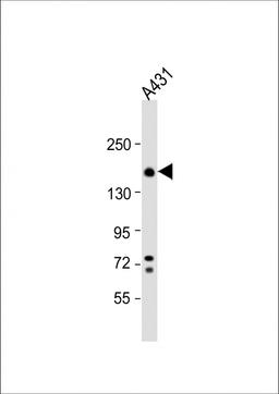 Western Blot at 1:1000 dilution + A431 whole cell lysate Lysates/proteins at 20 ug per lane.