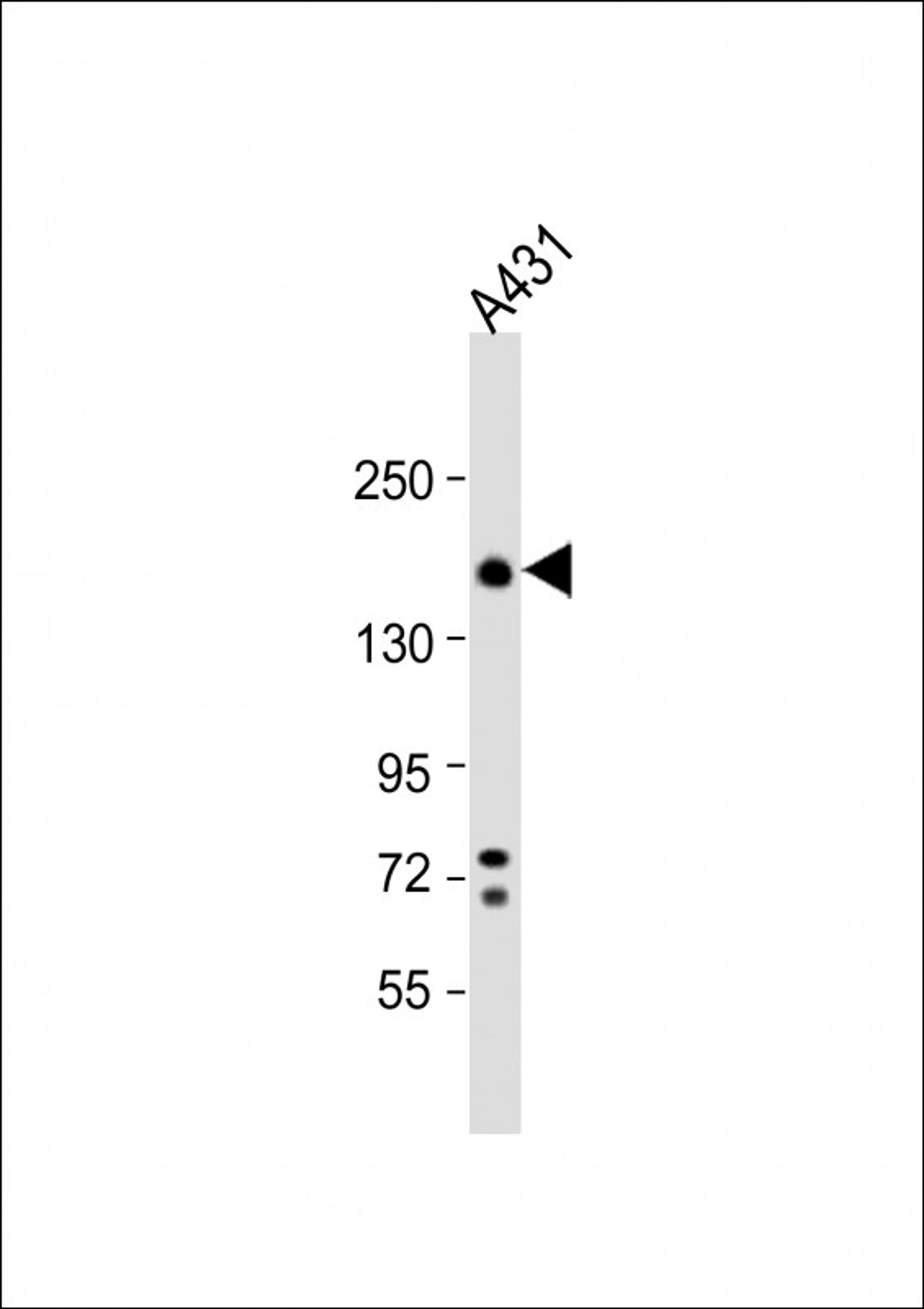 Western Blot at 1:1000 dilution + A431 whole cell lysate Lysates/proteins at 20 ug per lane.