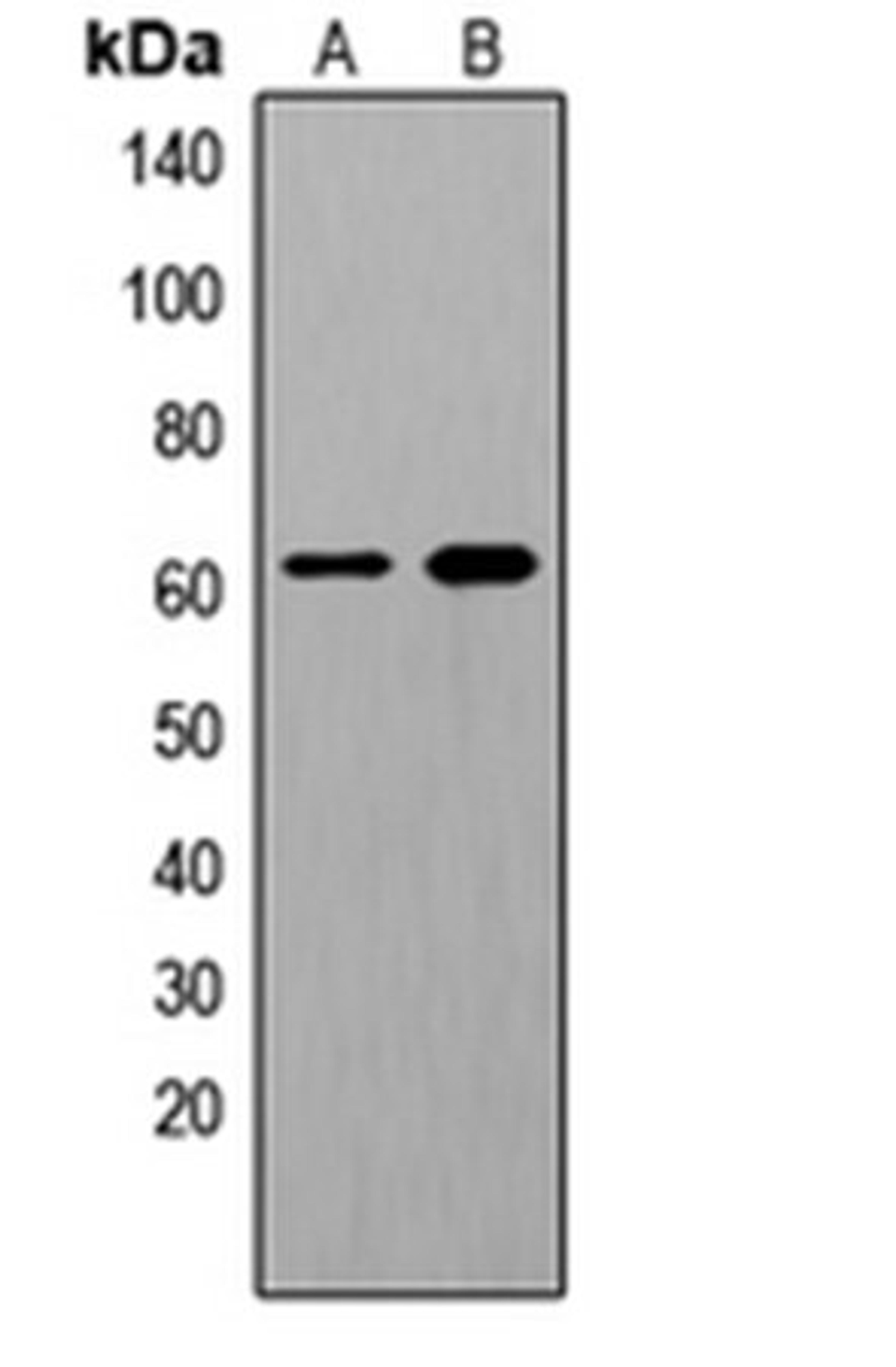 Western blot analysis of HeLa EGF-treated (Lane 1), HuvEc EGF-treated (Lane 2) whole cell lysates using SHCA (phospho-Y349) antibody