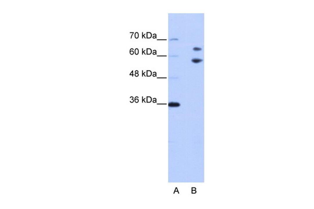 Antibody used in WB on Human Jurkat 0.2-1 ug/ml.