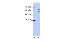 Antibody used in WB on Human Jurkat 0.2-1 ug/ml.