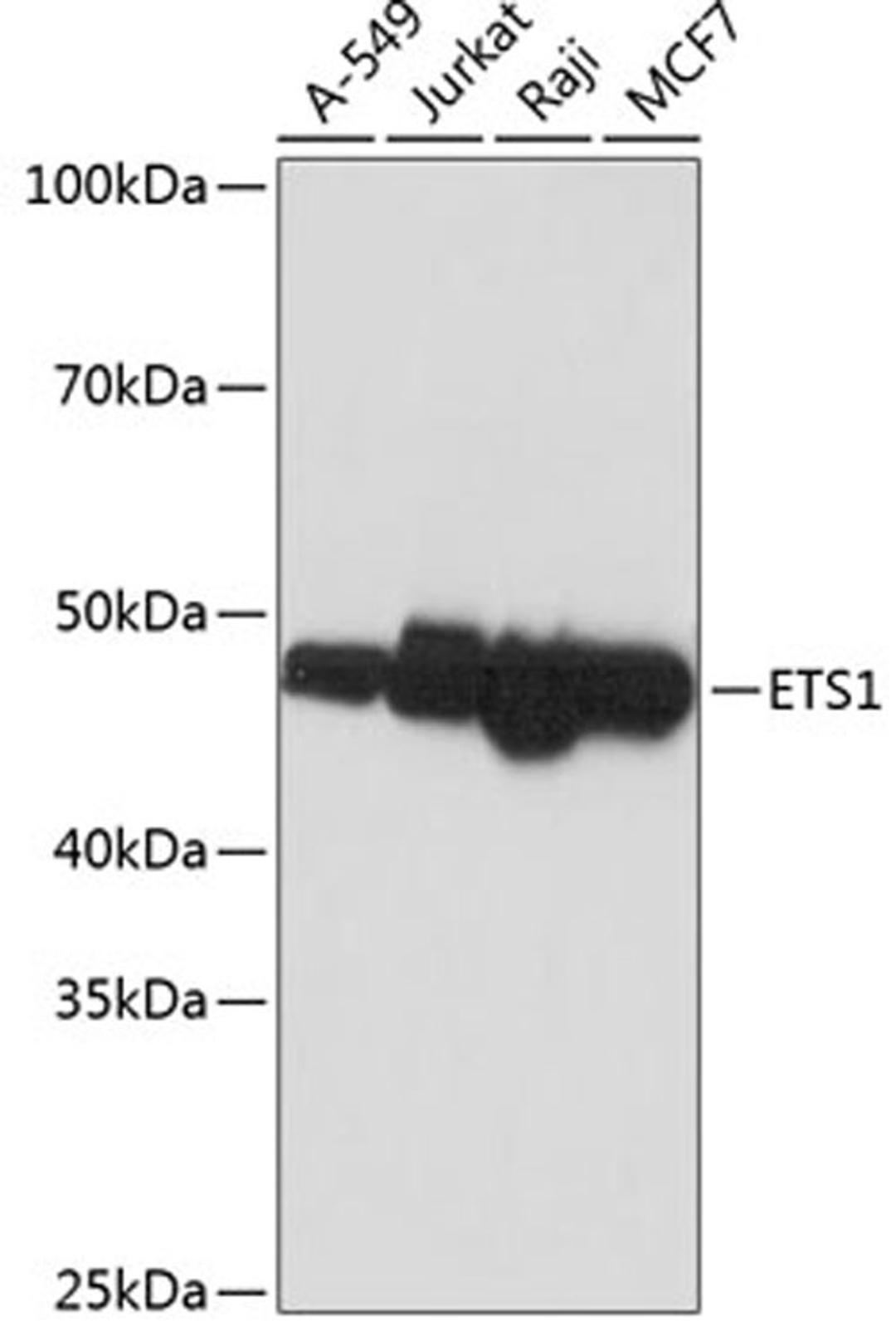 Western blot - ETS1 antibody (A19603)