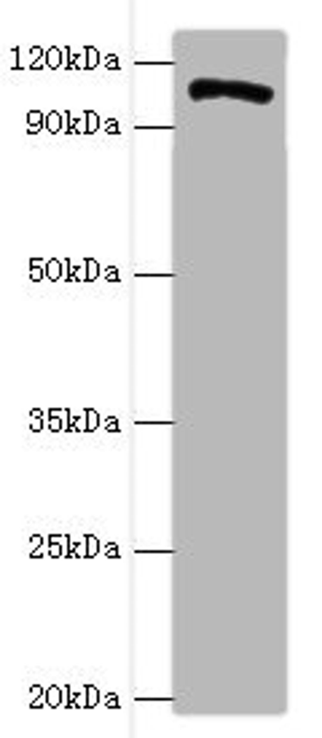 Western blot. All lanes: HIP1 antibody at 4ug/ml + A549 whole cell lysate. Secondary. Goat polyclonal to rabbit IgG at 1/10000 dilution. Predicted band size: 117, 111, 114 kDa. Observed band size: 117 kDa.