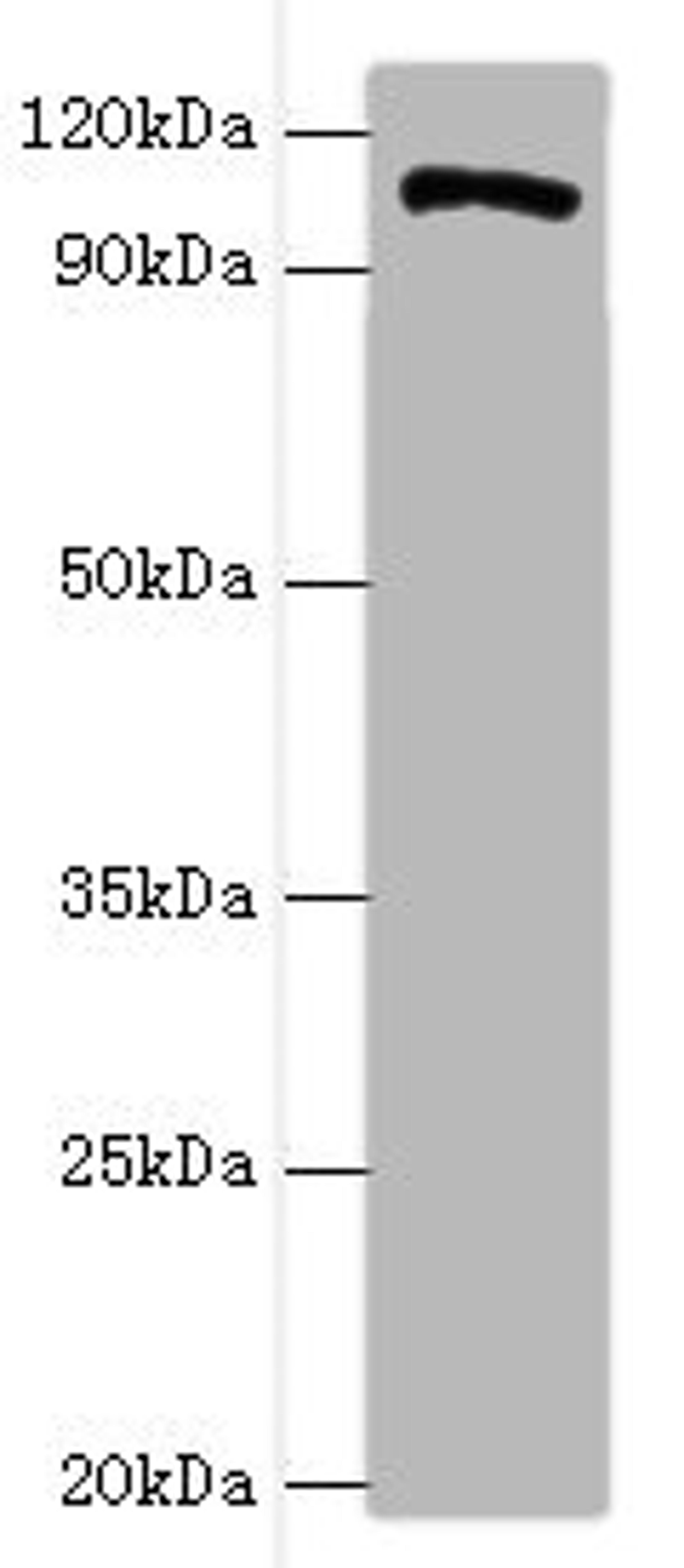 Western blot. All lanes: HIP1 antibody at 4ug/ml + A549 whole cell lysate. Secondary. Goat polyclonal to rabbit IgG at 1/10000 dilution. Predicted band size: 117, 111, 114 kDa. Observed band size: 117 kDa.