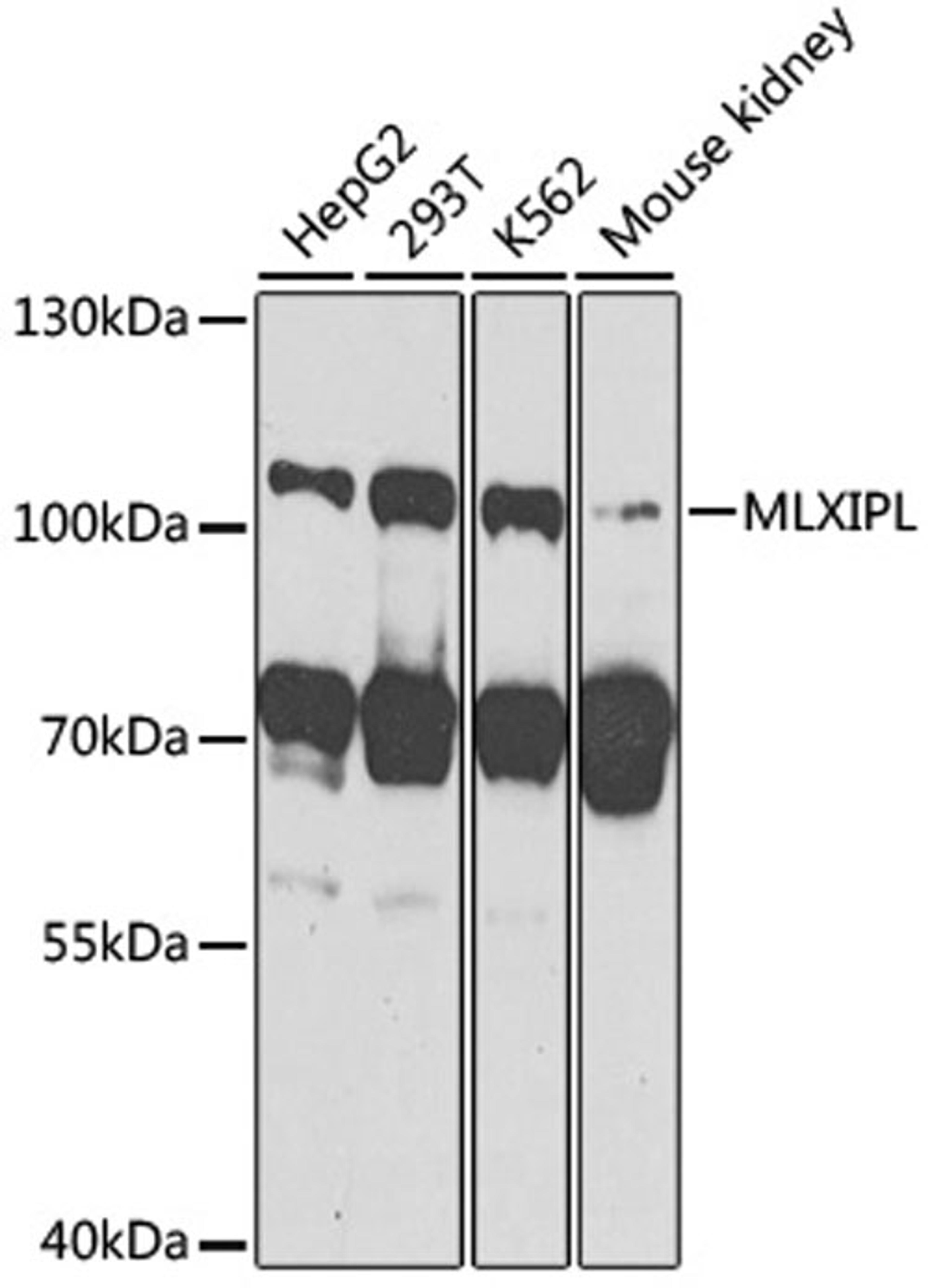 Western blot - MLXIPL antibody (A7630)