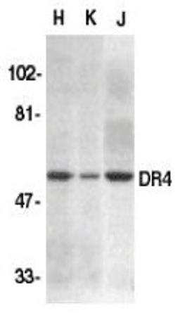 Western blot analysis for whole cell lysates from HeLa (H), K562 (K0 and Jurkat (J) cell lines