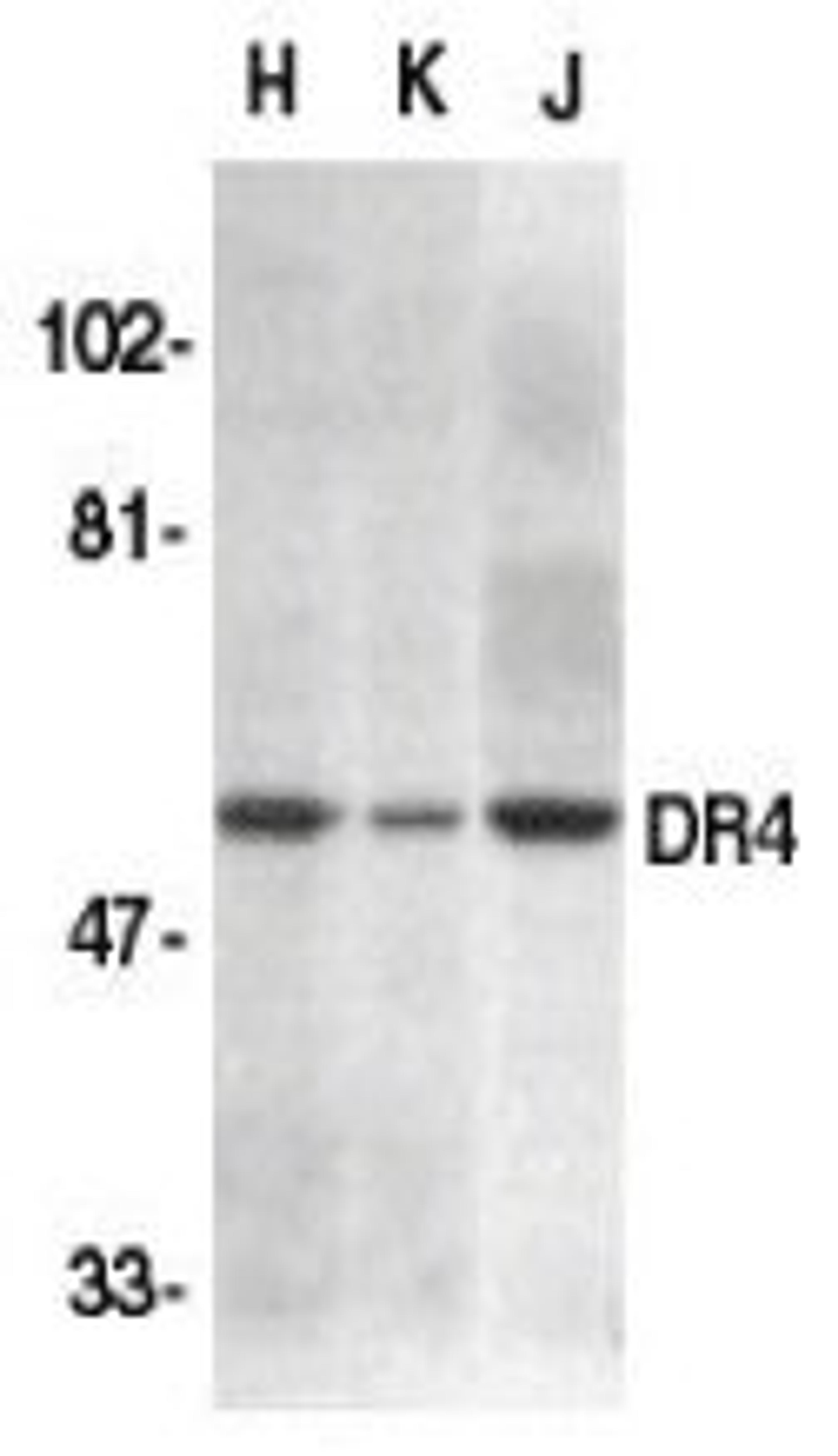 Western blot analysis for whole cell lysates from HeLa (H), K562 (K0 and Jurkat (J) cell lines