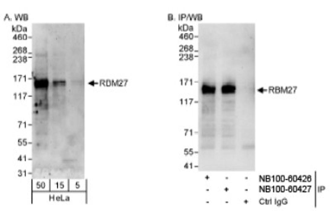 Western Blot: RBM27 Antibody [NB100-60426] - Detection of Human RBM27 on HeLa whole cell lysate using NB100-60426. RBM27 was also immunoprecipitated by rabbit anti-RBM27 antibody NB100-60427.