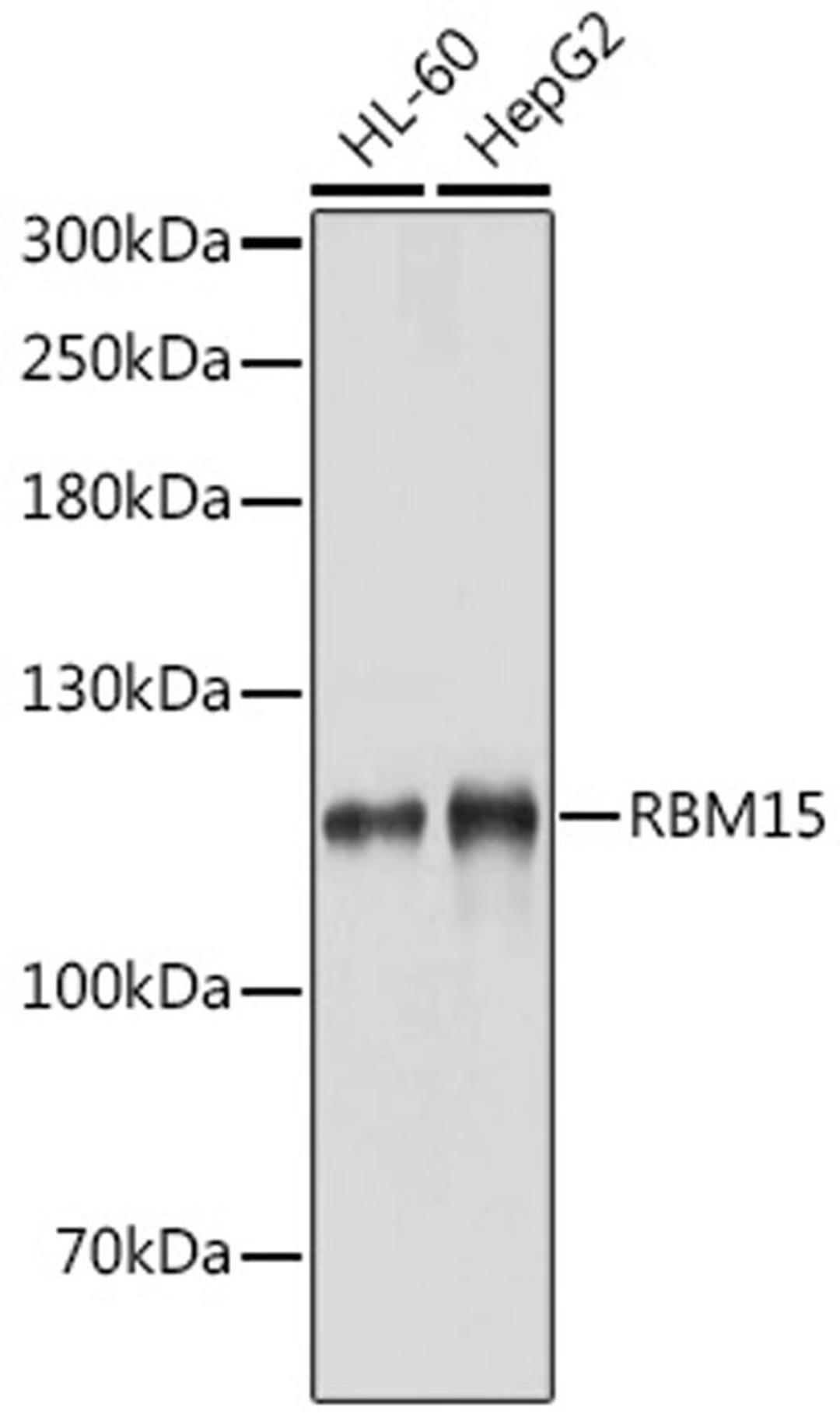 Western blot - RBM15 antibody (A4936)