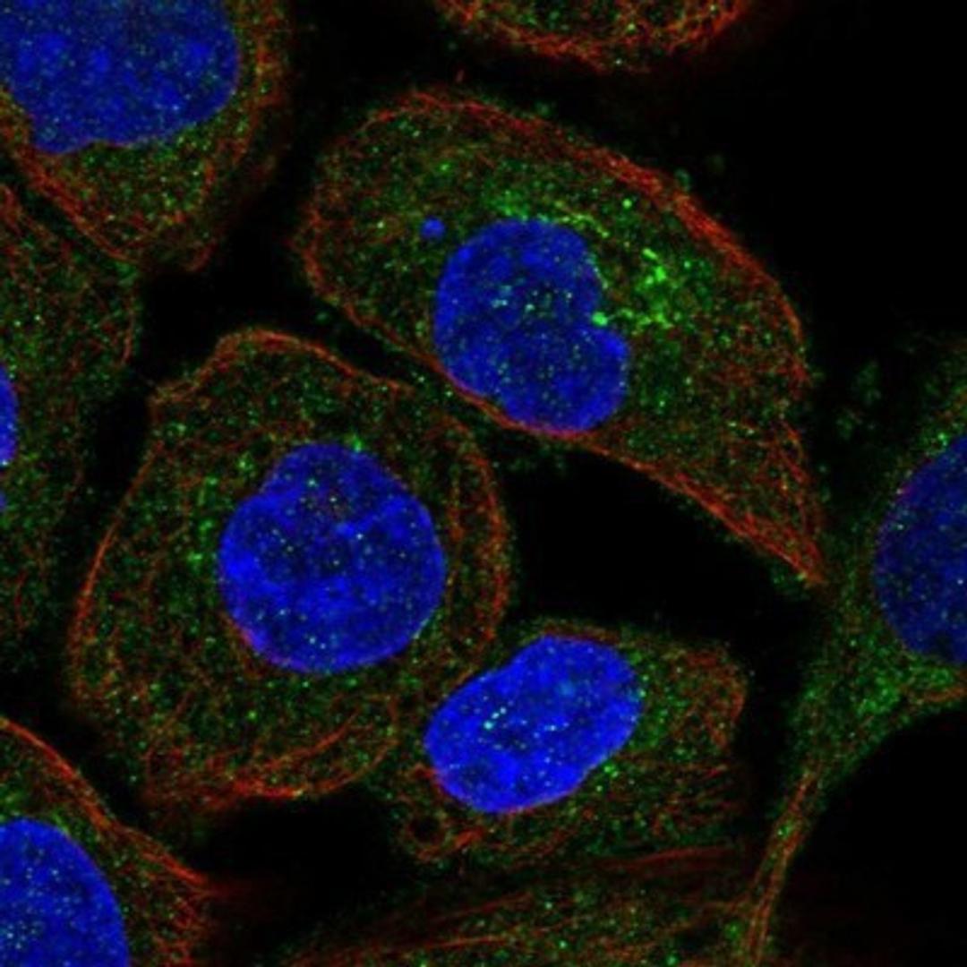 Immunocytochemistry/Immunofluorescence: TRAPPC3 Antibody [NBP1-88664] - Staining of human cell line A-431 shows positivity in golgi apparatus.