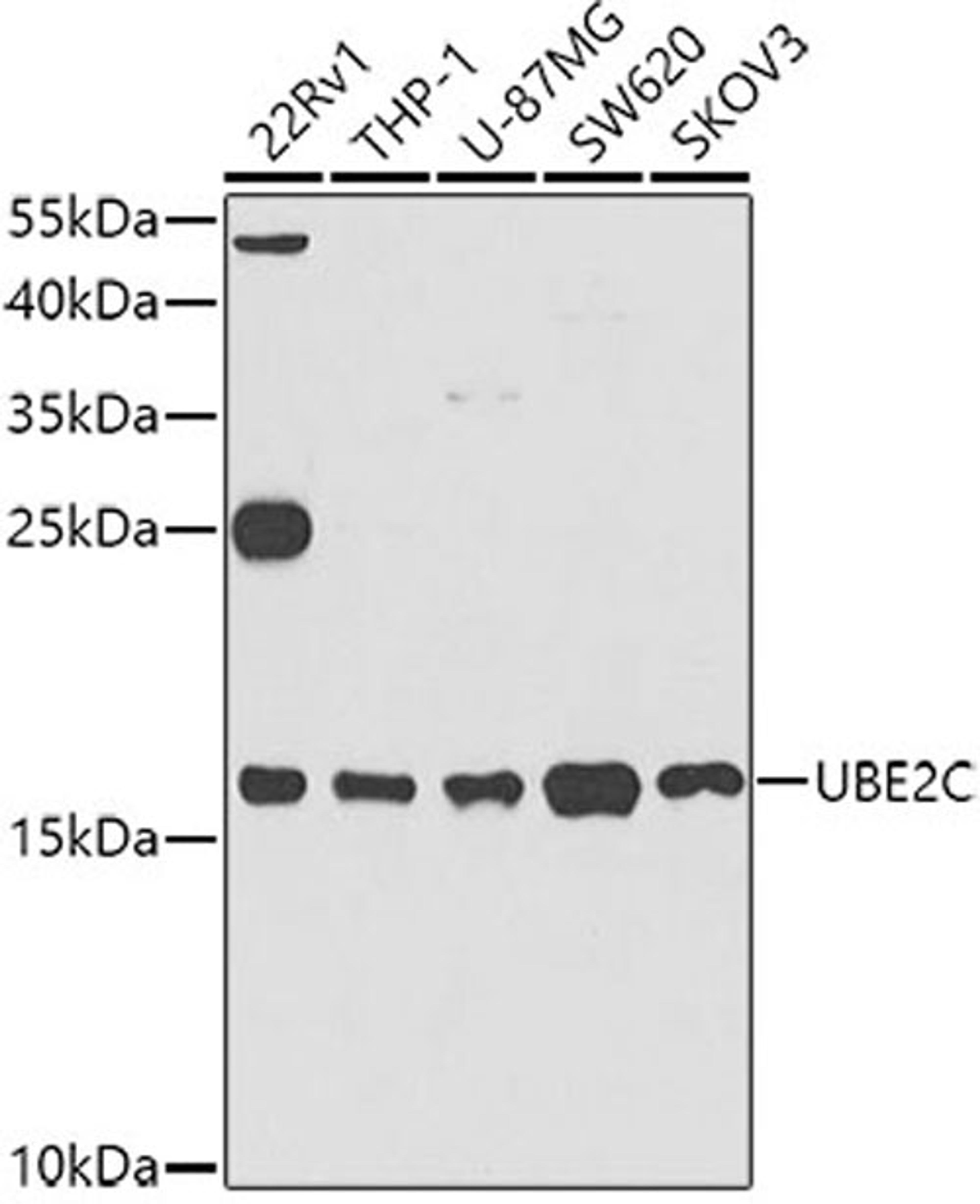 Western blot - UBE2C antibody (A5499)