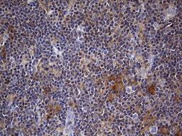 Immunohistochemistry: Kynureninase Antibody (1H1) [NBP2-45579] - Analysis of Human lymphoma tissue.