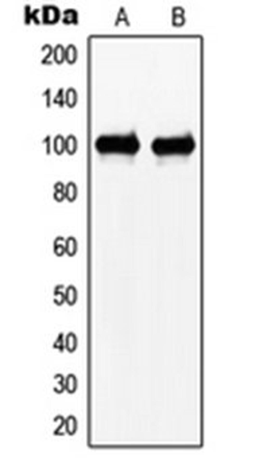 Western blot analysis of HeLa (Lane 1), Jurkat (Lane 2) whole cell lysates using N4BP1 antibody