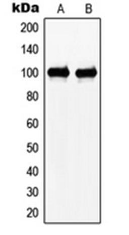 Western blot analysis of HeLa (Lane 1), Jurkat (Lane 2) whole cell lysates using N4BP1 antibody