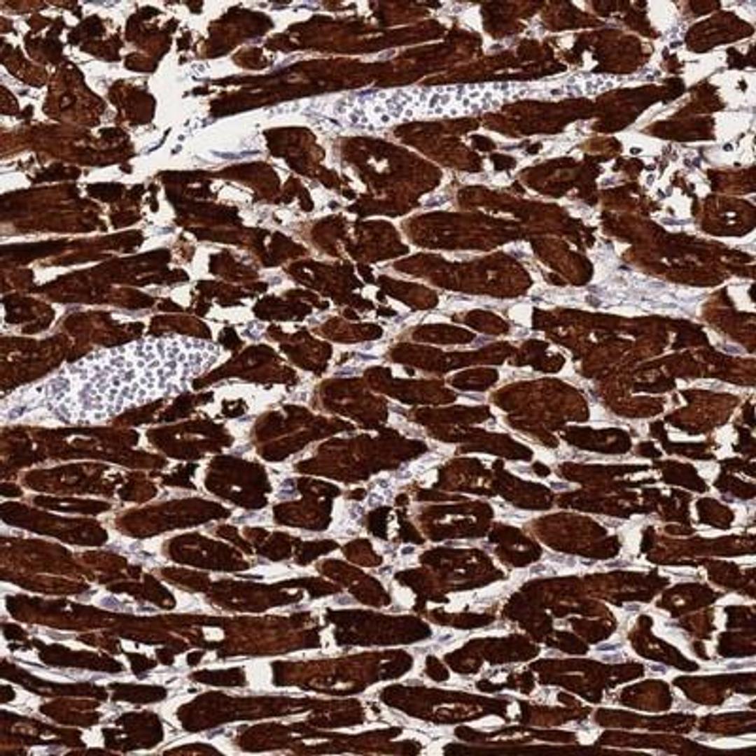 Immunohistochemistry-Paraffin: MyBPC3 Antibody [NBP2-13632] - MYBPC3 Antibody [NBP2-13632] - Staining of human heart muscle shows strong cytoplasmic positivity in myocytes.