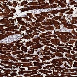 Immunohistochemistry-Paraffin: MyBPC3 Antibody [NBP2-13632] - MYBPC3 Antibody [NBP2-13632] - Staining of human heart muscle shows strong cytoplasmic positivity in myocytes.