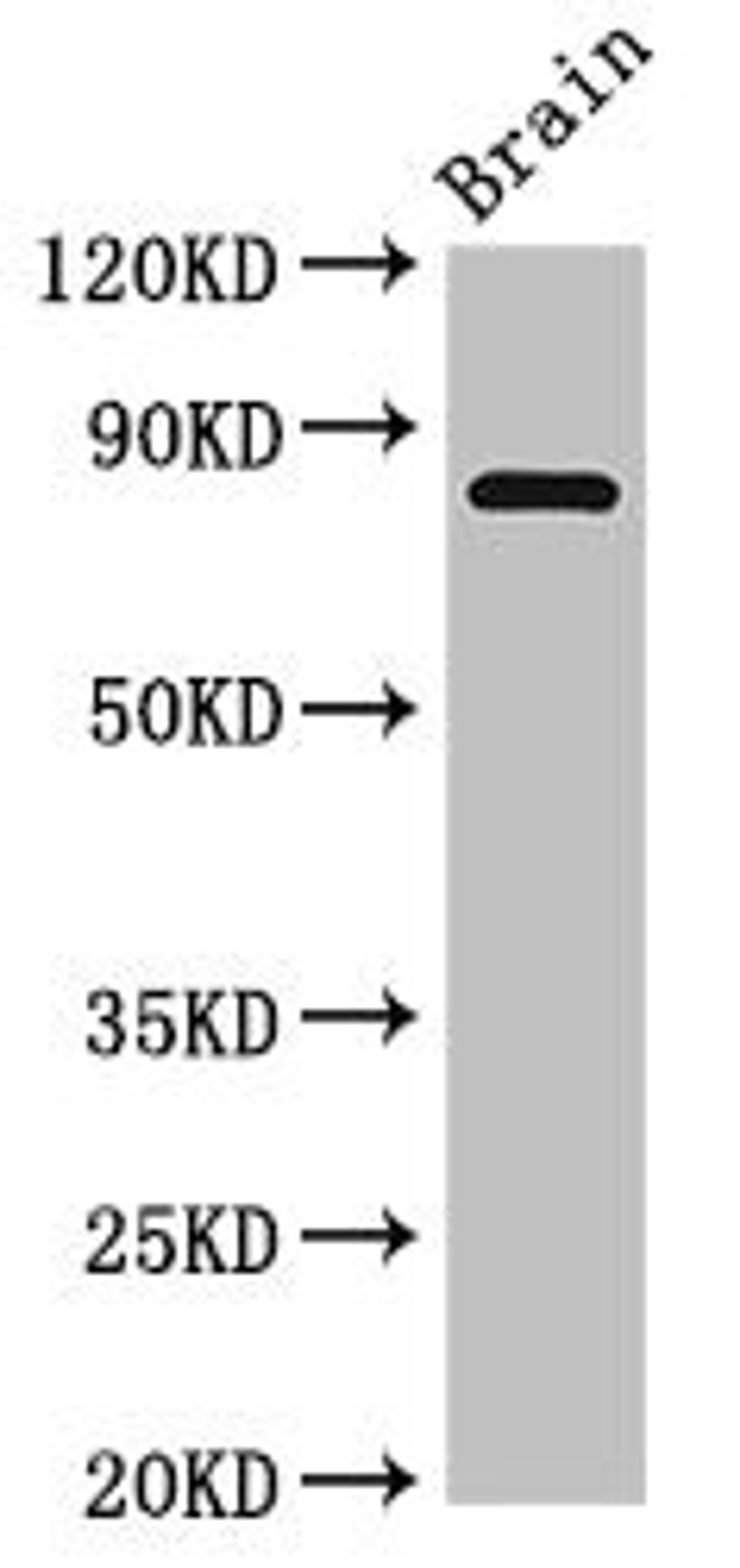 Western Blot. Positive WB detected in: Rat brain tissue. All lanes: Loxl4 antibody at 4ug/ml. Secondary. Goat polyclonal to rabbit IgG at 1/50000 dilution. Predicted band size: 85 kDa. Observed band size: 85 kDa. 
