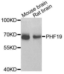 Western blot analysis of extracts of various cells using PHF19 antibody