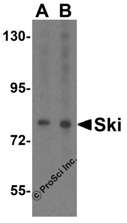 Western blot analysis of Ski in HeLa cell lysate with Ski antibody at (A) 1 and (B) 2 μg/mL.