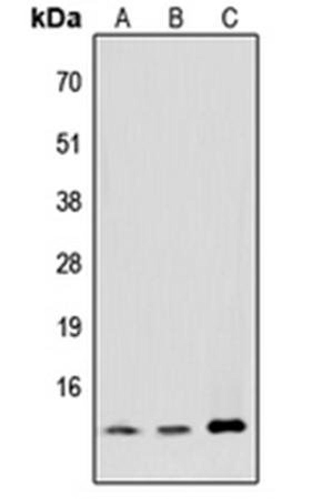 Western blot analysis of HeLa (Lane1), NIH3T3 (Lane2), PC12 (Lane3) whole cell using MED11 antibody