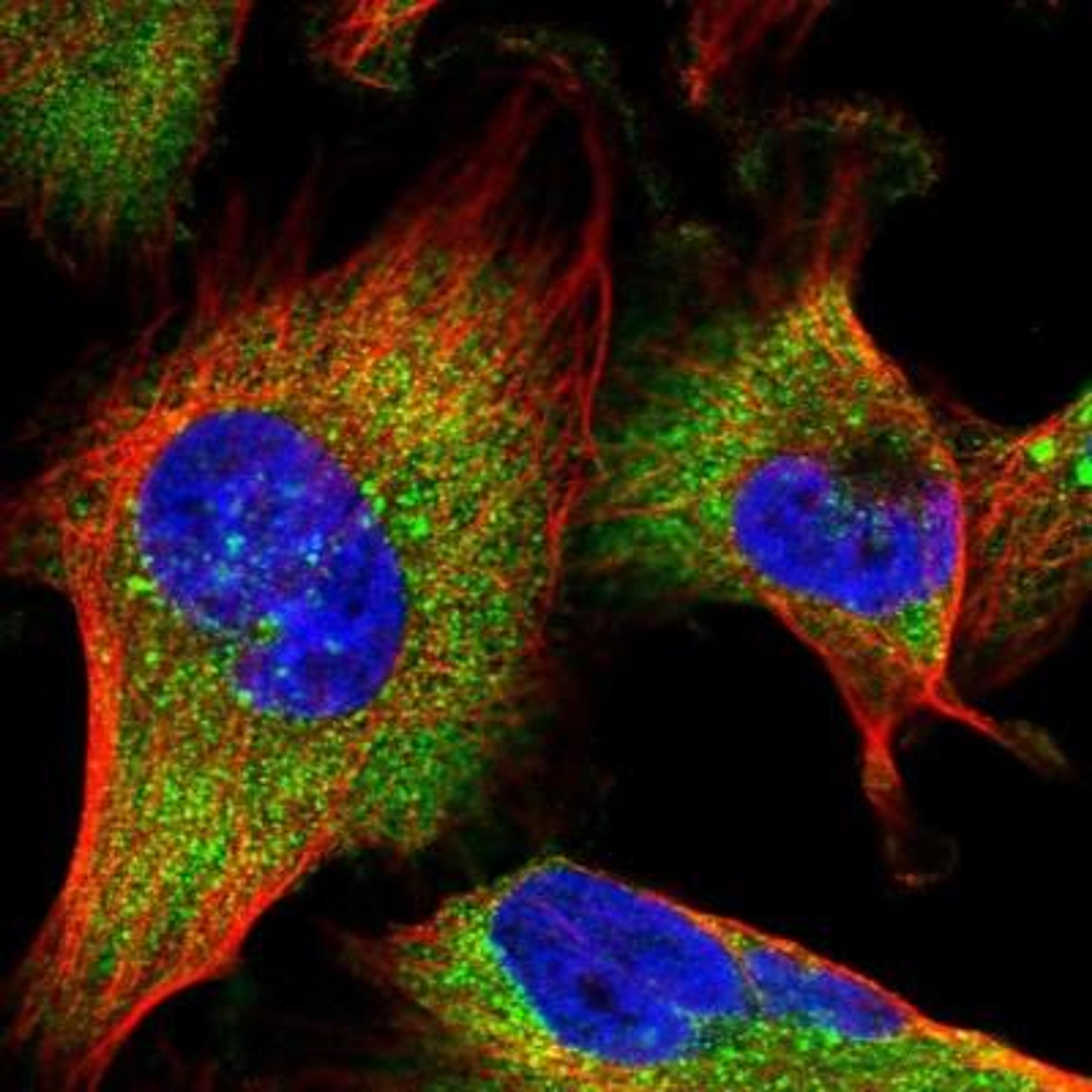 Immunocytochemistry: MON1B Antibody [NBP1-92131] - Immunofluorescence:  [NBP1-92131] - Staining of human cell line U-251 MG shows positivity in cytoplasm.