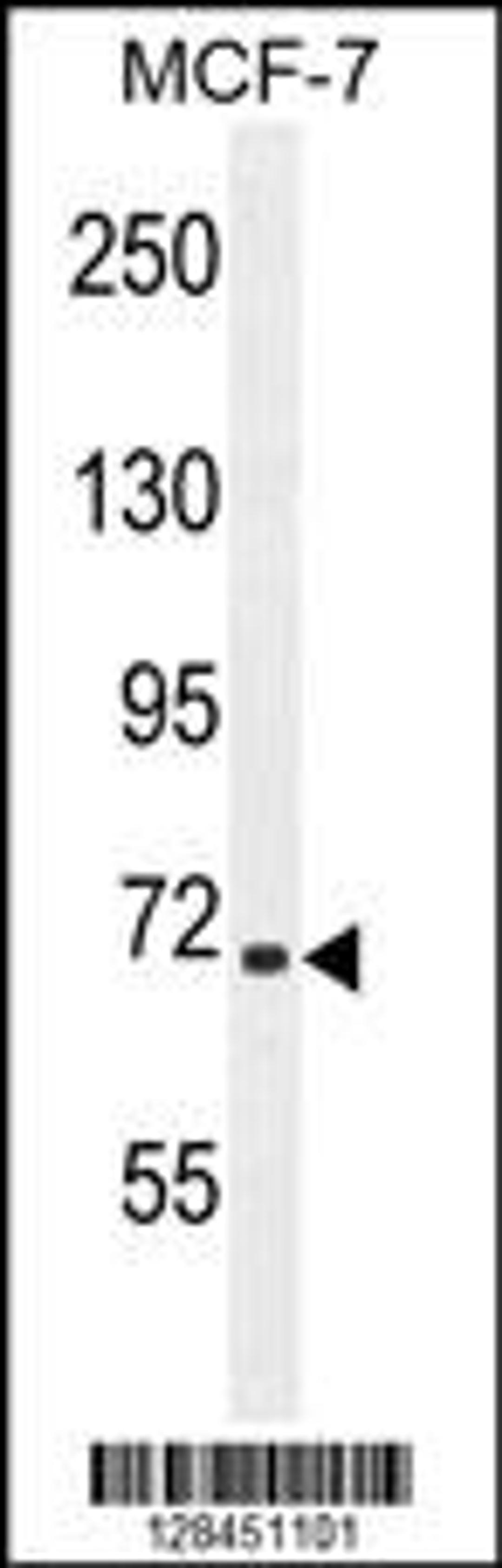 Western blot analysis in MCF-7 cell line lysates (35ug/lane).