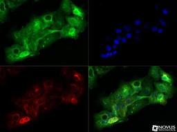 Immunocytochemistry/Immunofluorescence: TRIF/TICAM1 Antibody [NB120-13810] - TRIF antibody was tested in A431 cells with Dylight 488 (green). Nuclei and alpha-tubulin were counterstained with DAPI (blue) and Dylight 550 (red). Image objective 40x. An antibody dilution of 1:10 was used.