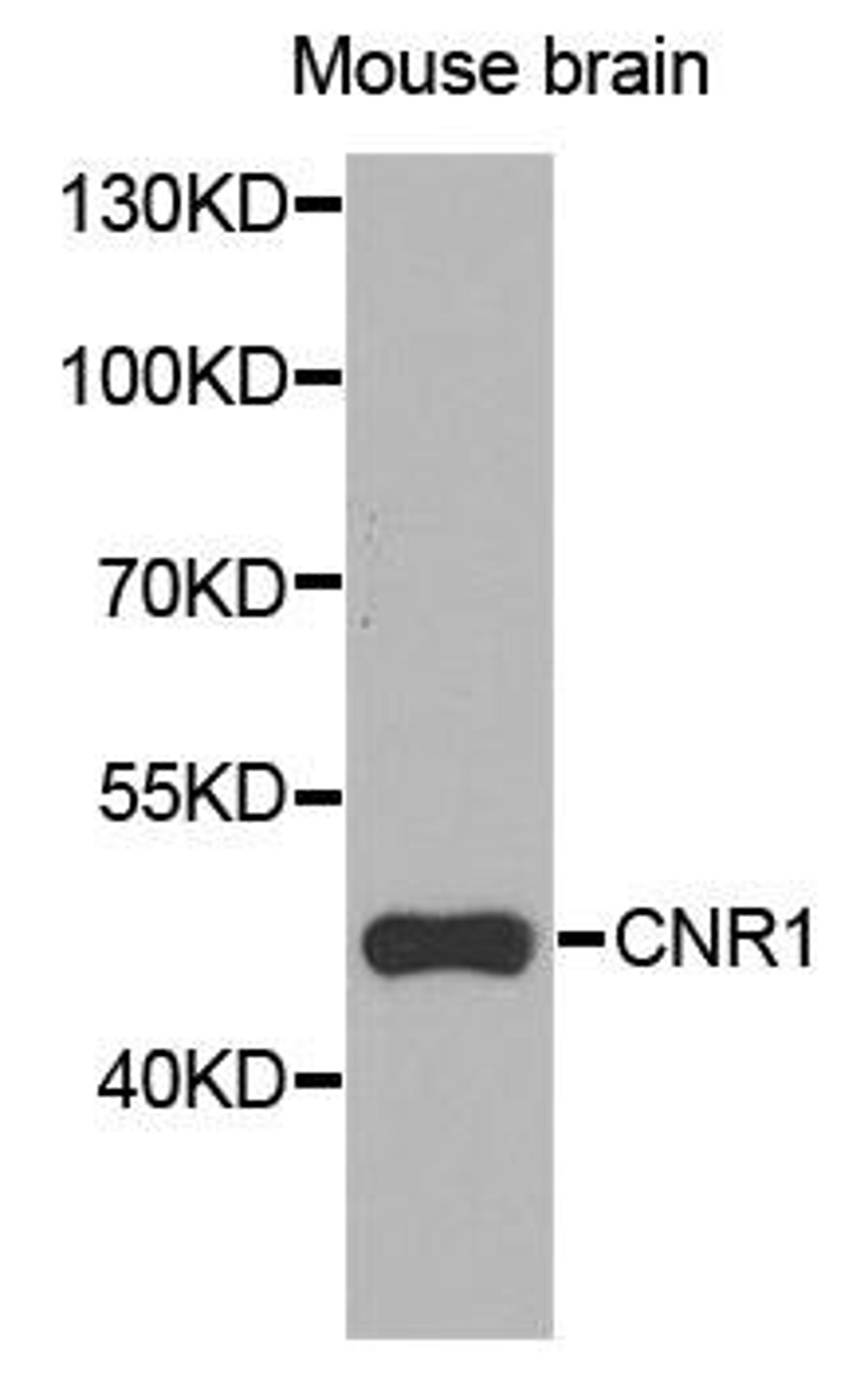 Western blot analysis of extracts of mouse brain cells using CNR1 antibody