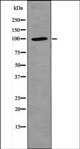 Western blot analysis of ATP1 Rat braintissue lysates using NFAT1 -Phospho-Ser326- antibody