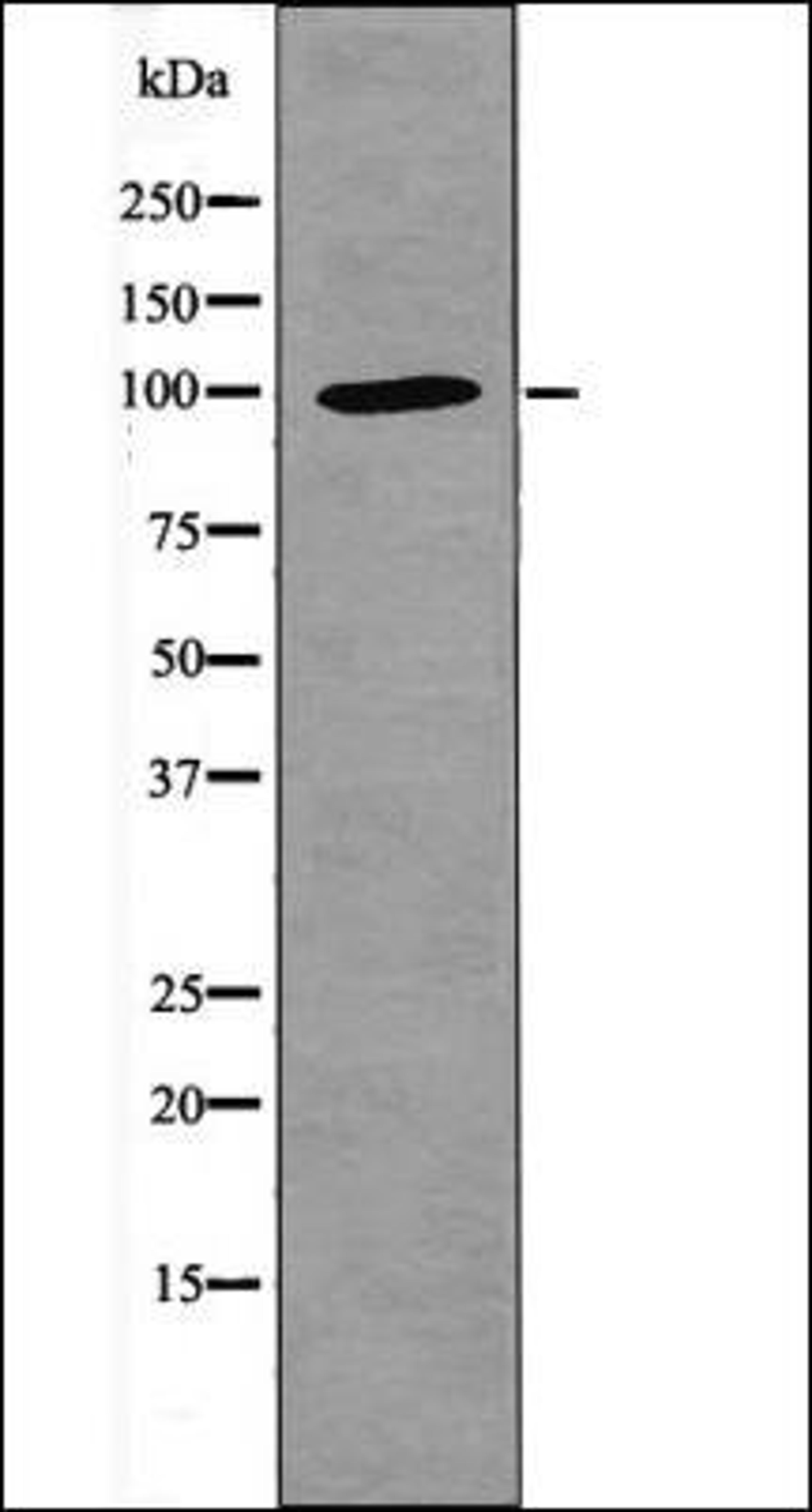 Western blot analysis of ATP1 Rat braintissue lysates using NFAT1 -Phospho-Ser326- antibody