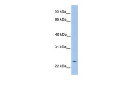 Antibody used in WB on Human HepG2 at 0.2-1 ug/ml.