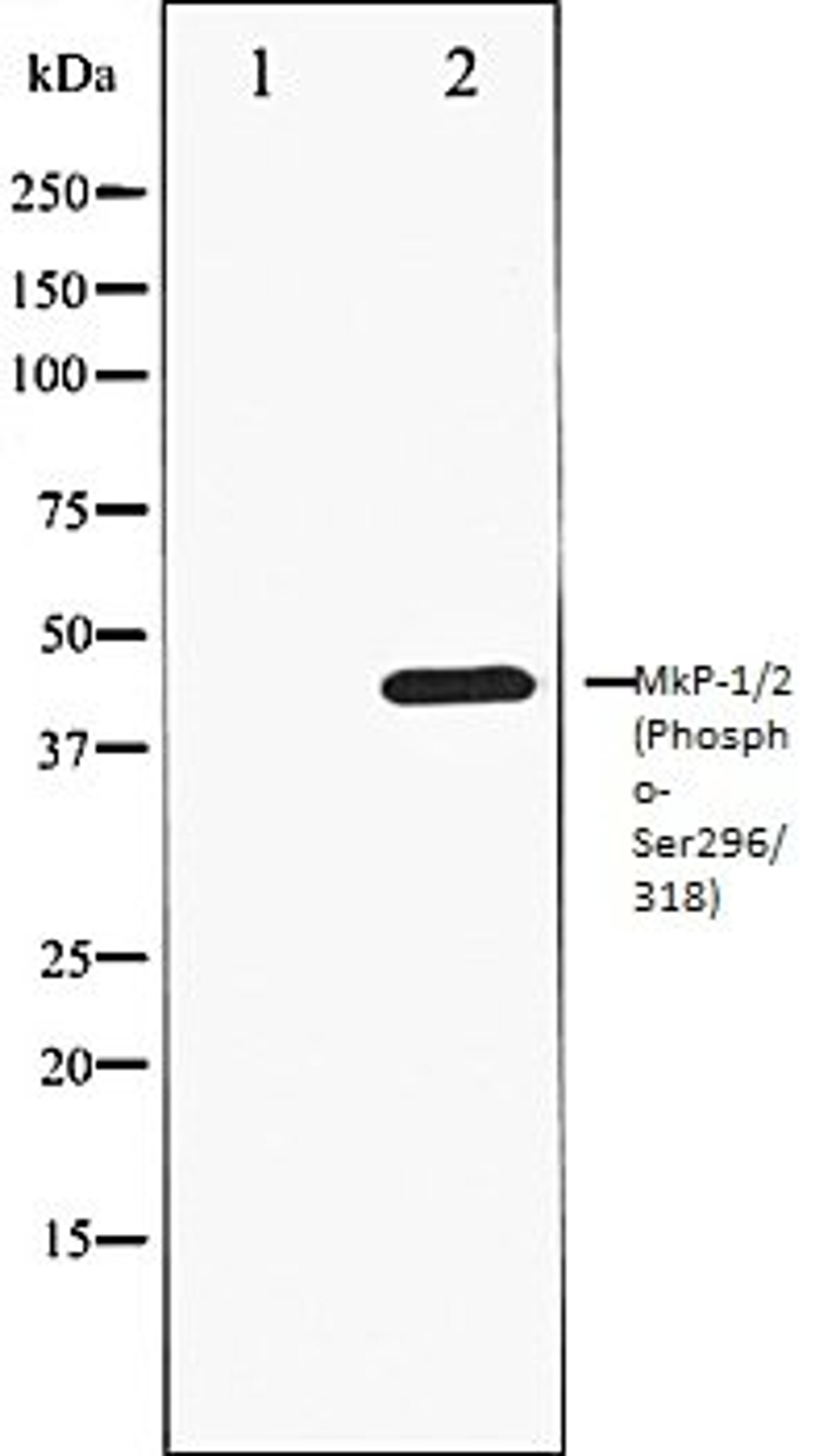 Western blot analysis of heatshockK562 whole cell lysates using MKP-1/2 (Phospho-Ser296/318) antibody, The lane on the left is treated with the antigen-specific peptide.