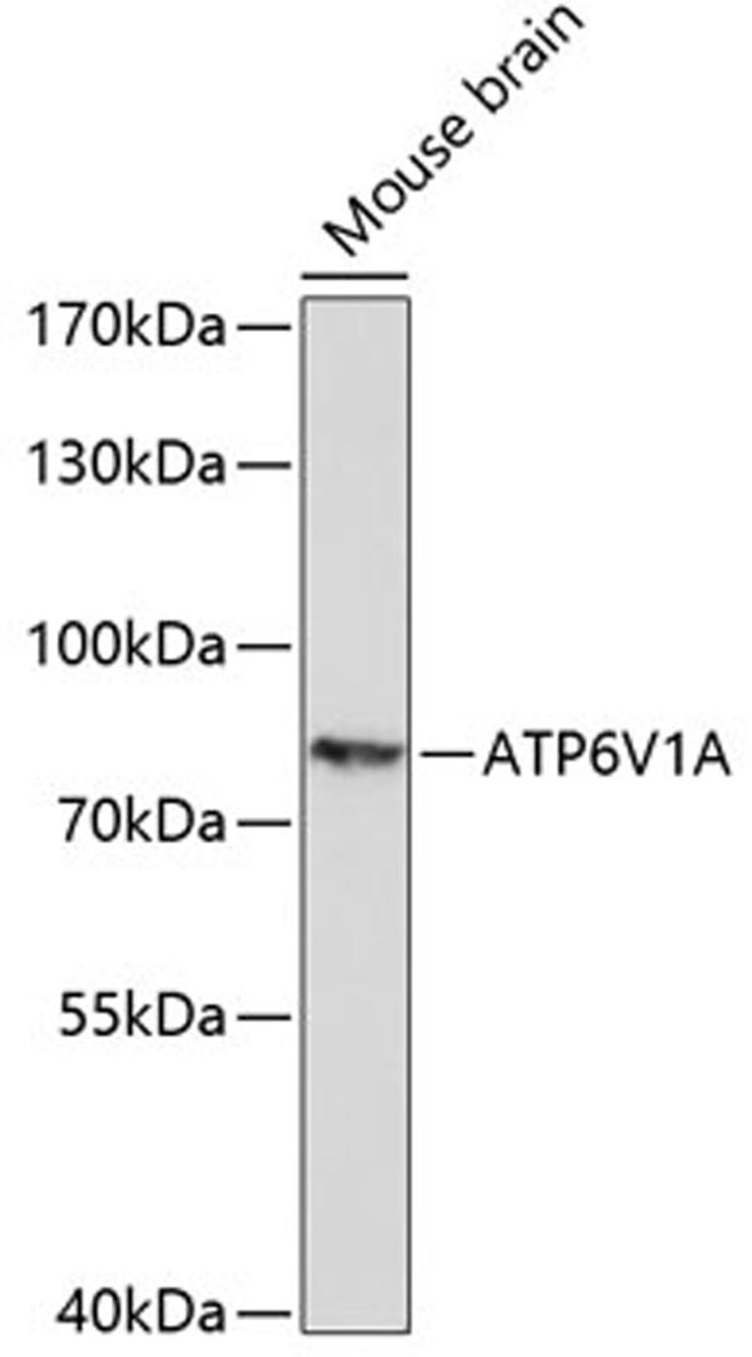 Western blot - ATP6V1A antibody (A14707)