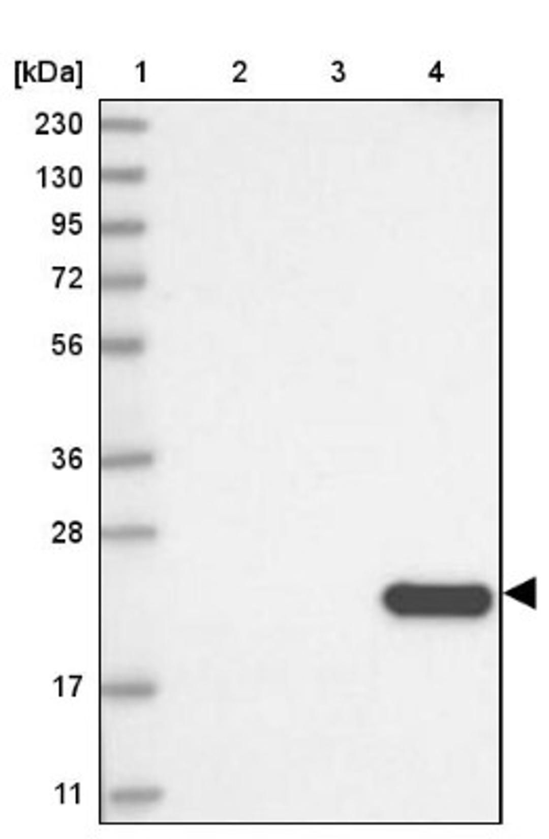 Western Blot: CLEC3B/Tetranectin Antibody [NBP2-38222] - Lane 1: Marker [kDa] 230, 130, 95, 72, 56, 36, 28, 17, 11<br/>Lane 2: RT-4<br/>Lane 3: U-251 MG<br/>Lane 4: Human Plasma