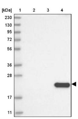 Western Blot: CLEC3B/Tetranectin Antibody [NBP2-38222] - Lane 1: Marker [kDa] 230, 130, 95, 72, 56, 36, 28, 17, 11<br/>Lane 2: RT-4<br/>Lane 3: U-251 MG<br/>Lane 4: Human Plasma